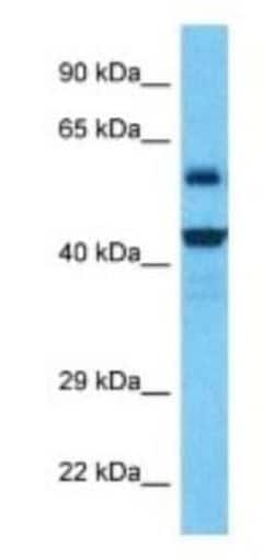 NUDT19 Rabbit anti-Human, Polyclonal, Novus Biologicals:Antibodies:Primary